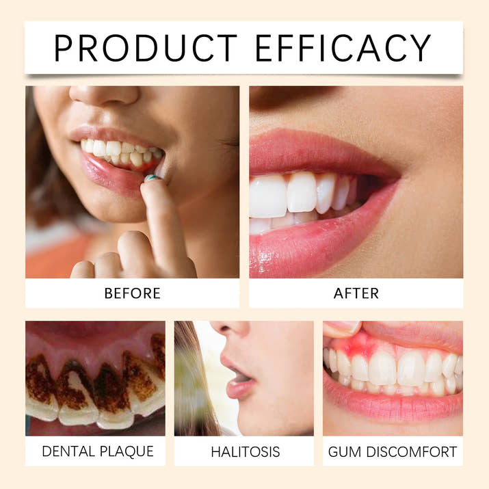 Gleivra PerioMint™ Gum Health & Whitening Solution