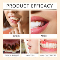 Gleivra PerioMint™ Gum Health & Whitening Solution
