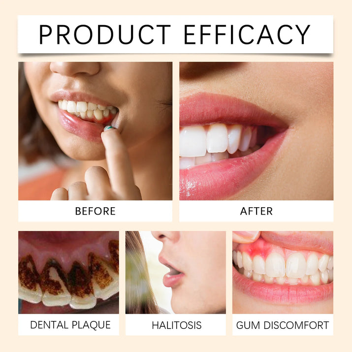Gleivra PerioMint™ Gum Health & Whitening Solution